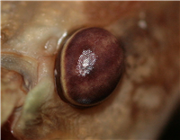 Eye of Aretaon Asperrimus